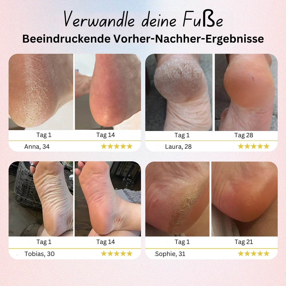 Elektrische Fußfeile