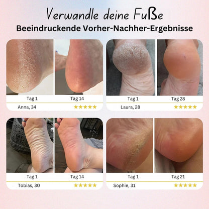 Elektrische Fußfeile